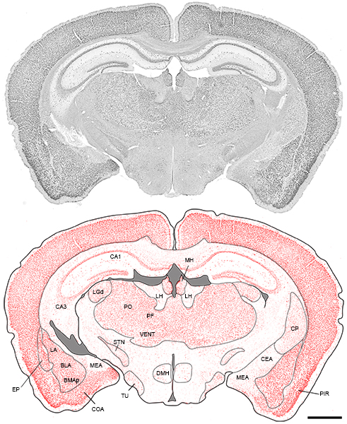 Fmrp In Mouse Brain College Of Medicine